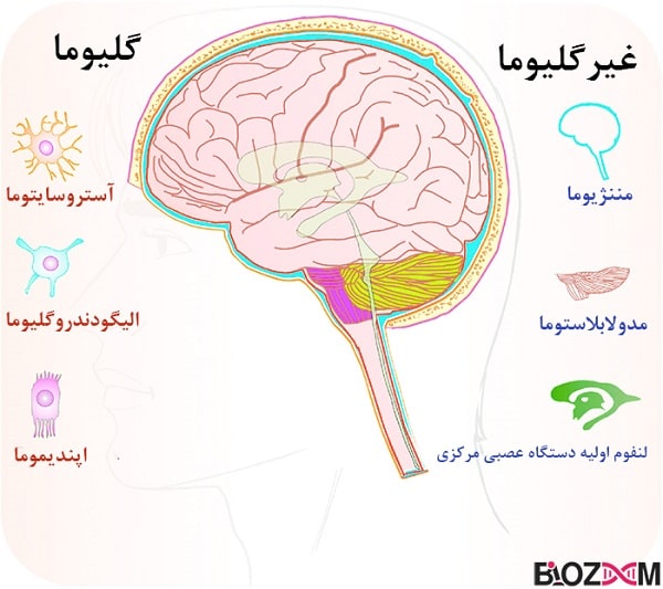 Schematic-diagram-showing-the-specific-types-of-cells-involved-in-brain-cancer تومور مغزی اولیه