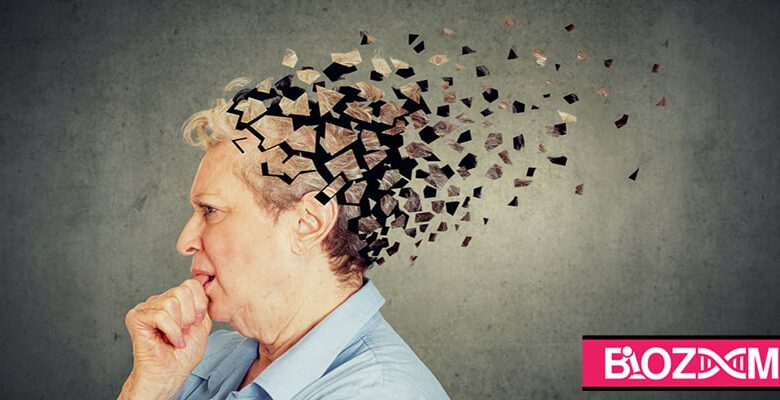 بیماری آلزایمر - فراموشی تدریجی