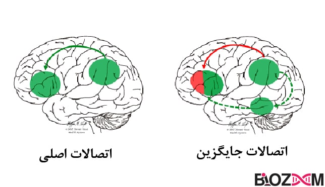 Cross-modal reassignment نوروپلاستیسیتی جابجایی چند وجهی