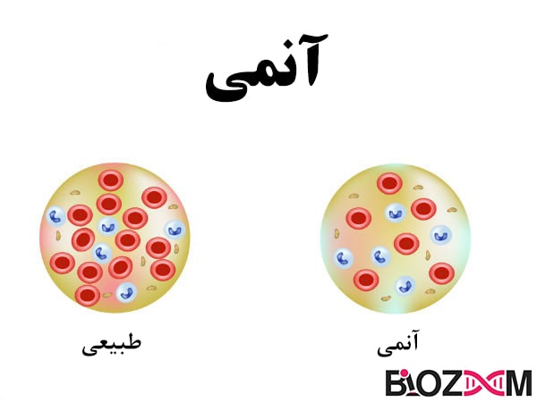 anemia آنمی یا کمخونی