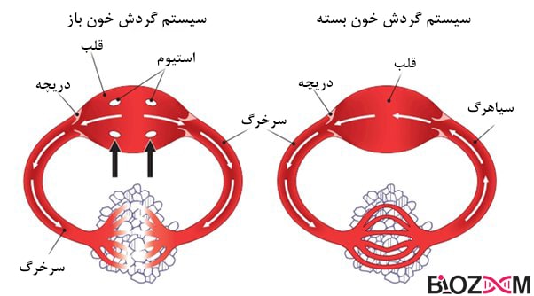 تصویر سیستم گردش خون بسته و دستگاه گردش خون باز