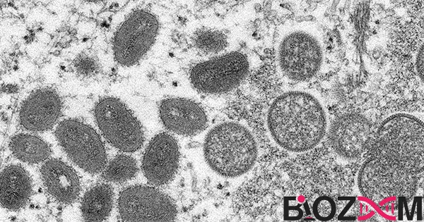 Monkeypox virus عامل آبله میمونی