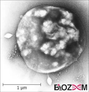 تصویر میکروسکوپی سولفولوبوس (Sulfolobus)، آرکئون از کلاس Crenarchaeota