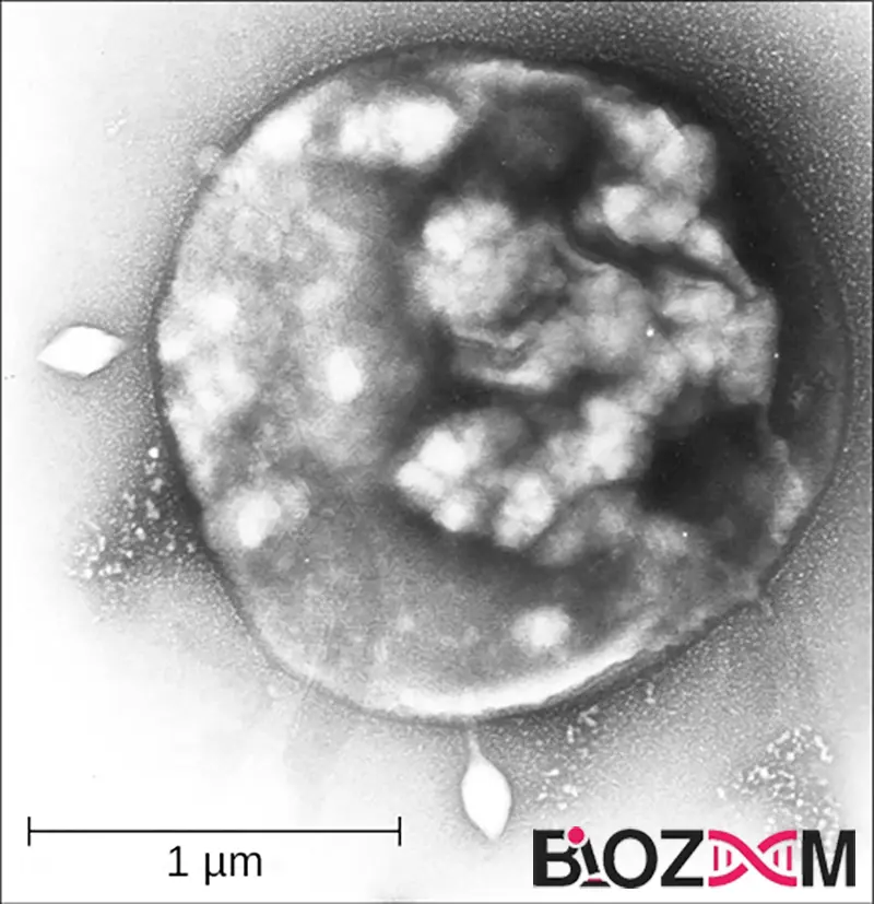 Sulfolobus تصویر میکروسکوپی سولفولوبوس (Sulfolobus)، آرکئون از کلاس Crenarchaeota