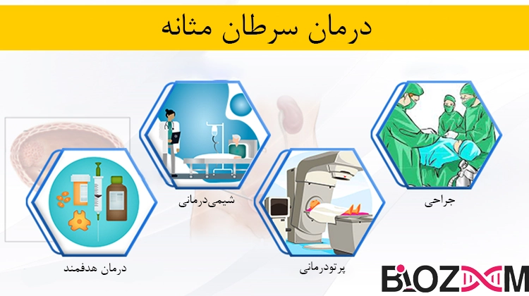 Treatment Of bladder Cancer انواع درمانهای سرطان مثانه