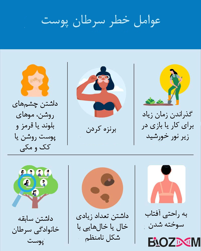 risk factors of skin cancer ریسک فاکتورهای سرطان پوست در انسان