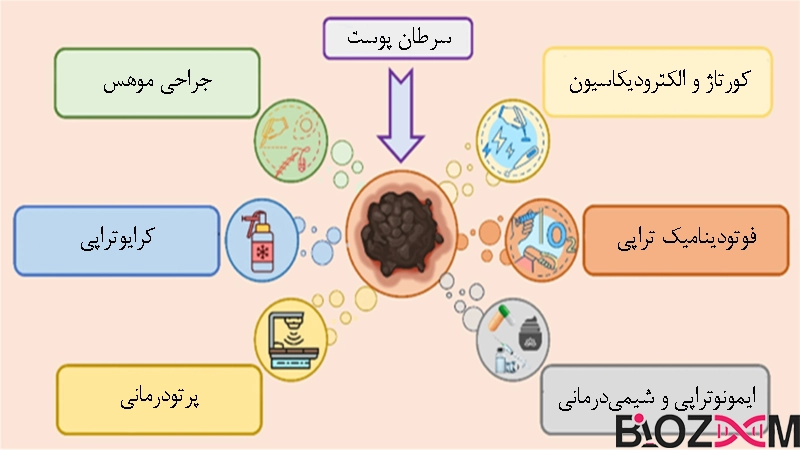 skin cancer treatment درمان سرطان پوست