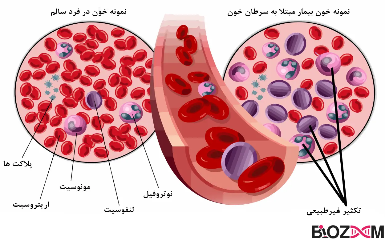 patients blood vs controls blood نمونه سرطان خون و خون سالم