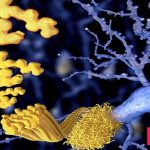 نقش بتا آمیلوئید در آلزایمر